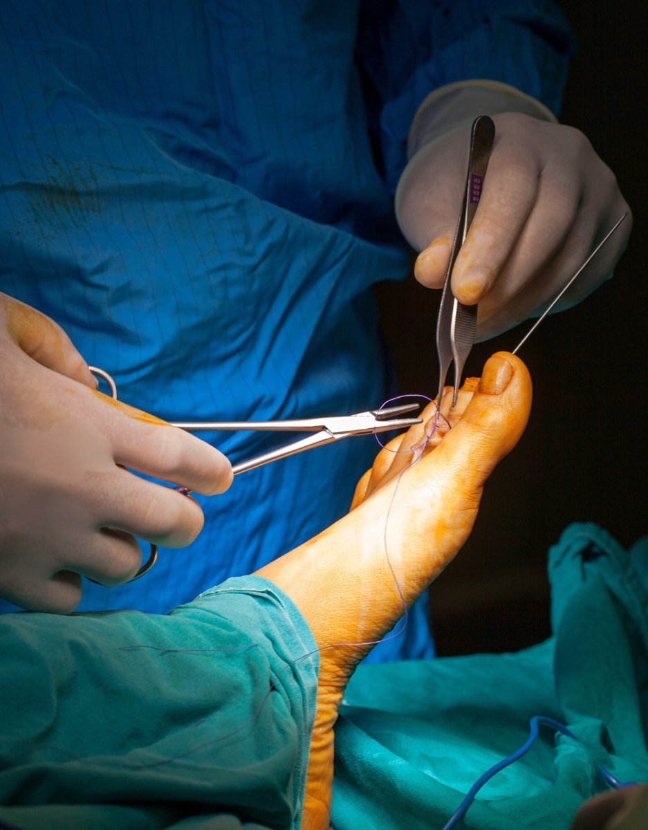 جراحات اليد والقدم